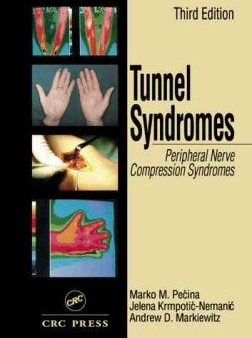 Tunnel Syndromes Online now