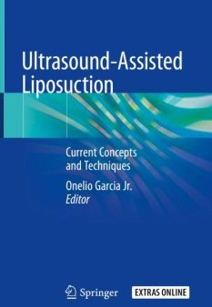 Ultrasound-Assisted Liposuction Sale