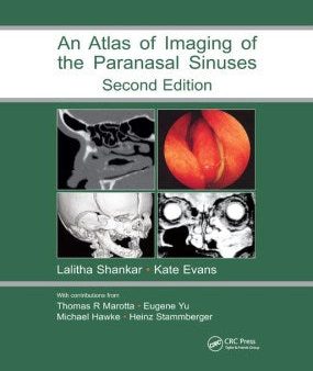 Atlas of Imaging of the Paranasal Sinuses Supply