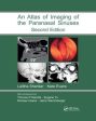 Atlas of Imaging of the Paranasal Sinuses Supply