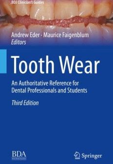 Tooth Wear Online now