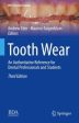 Tooth Wear Online now